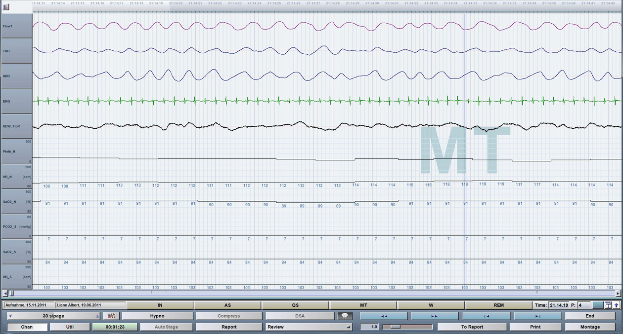 Polysomnographie Hersteller | PSG Geräte | alpha trace medical systems